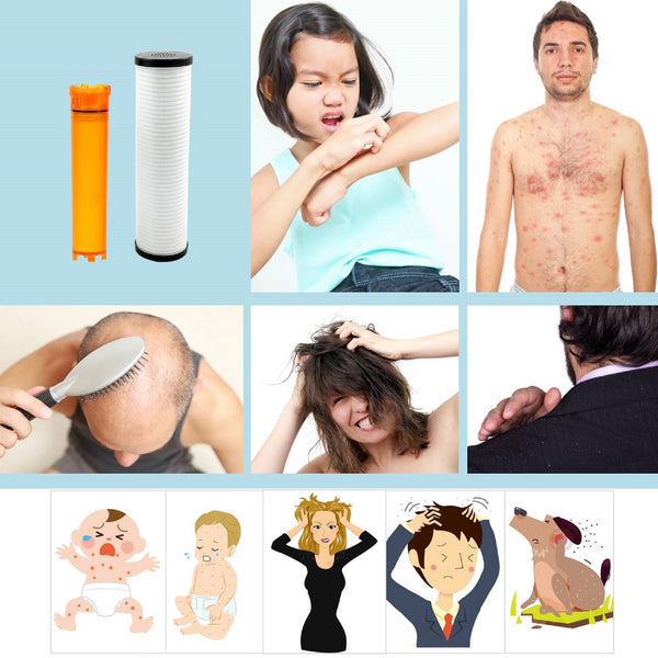 SUF-300VPX VitaPure Inline Shower Filter & Water Softener #1 Compact Shower Filter System in the world